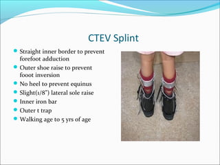 CTEV Splint
 Straight inner border to prevent
  forefoot adduction
 Outer shoe raise to prevent
  fooot inversion
 No heel to prevent equinus
 Slight(1/8”) lateral sole raise
 Inner iron bar
 Outer t trap
 Walking age to 5 yrs of age
 