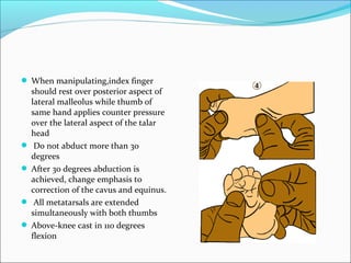  When manipulating,index finger
  should rest over posterior aspect of
  lateral malleolus while thumb of
  same hand applies counter pressure
  over the lateral aspect of the talar
  head
 Do not abduct more than 30
  degrees
 After 30 degrees abduction is
  achieved, change emphasis to
  correction of the cavus and equinus.
 All metatarsals are extended
  simultaneously with both thumbs
 Above-knee cast in 110 degrees
  flexion
 
