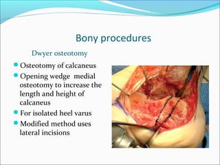 Bony procedures
     Dwyer osteotomy
Osteotomy of calcaneus
Opening wedge medial
 osteotomy to increase the
 length and height of
 calcaneus
For isolated heel varus
Modified method uses
 lateral incisions
 