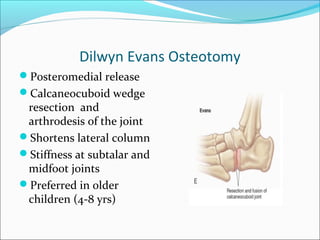 Dilwyn Evans Osteotomy
Posteromedial release
Calcaneocuboid wedge
 resection and
 arthrodesis of the joint
Shortens lateral column
Stiffness at subtalar and
 midfoot joints
Preferred in older
 children (4-8 yrs)
 