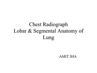 Chest Radiograph
Lobar & Segmental Anatomy of
Lung
AMIT JHA
 