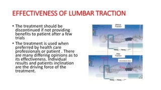 EFFECTIVENESS OF LUMBAR TRACTION
• The treatment should be
discontinued if not providing
benefits to patient after a few
trials
• The treatment is used when
preferred by health care
professionals or patient . There
are many differing opinions as to
its effectiveness. Individual
results and patients inclination
are the driving force of the
treatment.
 