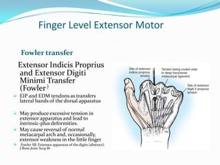 Finger Extensor Tendon Excursion Susil seminar claw hand | PPTX