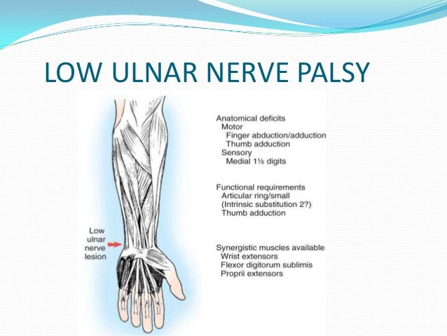 Susil seminar claw hand