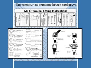 Ган татлагыг зангилаанд бэхлэх хэлбэрүүд
 