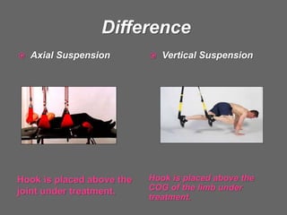 Difference
Hook is placed above the
joint under treatment.
Hook is placed above the
COG of the limb under
treatment.
 Axial Suspension  Vertical Suspension
 