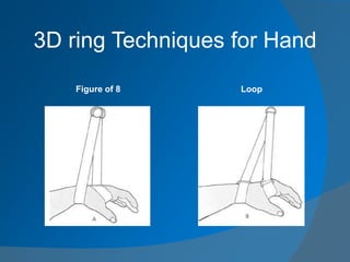 3D ring Techniques for Hand
Figure of 8 Loop
 
