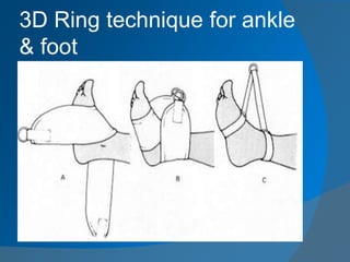 3D Ring technique for ankle
& foot
 