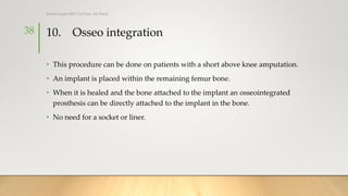 10. Osseo integration
• This procedure can be done on patients with a short above knee amputation.
• An implant is placed within the remaining femur bone.
• When it is healed and the bone attached to the implant an osseointegrated
prosthesis can be directly attached to the implant in the bone.
• No need for a socket or liner.
38
Rohan Gupta MPO 1st Year, 3rd Batch
 
