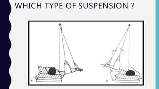 WHICH TYPE OF SUSPENSION ?
 