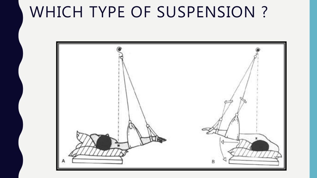 Suspension therapy