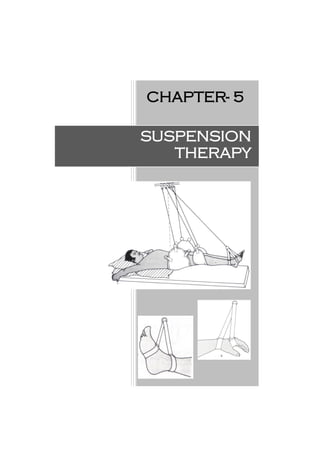CHAPTER- 5
SUSPENSION
THERAPY
 