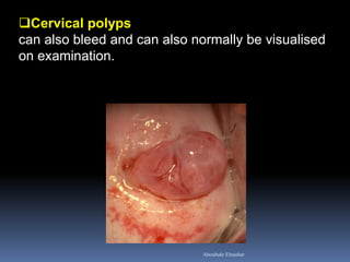 Cervical polyps can also bleed and can also normally be visualised on examination. 
Aboubakr Elnashar  