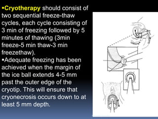 Cryotherapy should consist of two sequential freeze-thaw cycles, each cycle consisting of 3 min of freezing followed by 5 minutes of thawing (3min freeze-5 min thaw-3 min freezethaw). 
Adequate freezing has been achieved when the margin of the ice ball extends 4-5 mm past the outer edge of the cryotip. This will ensure that cryonecrosis occurs down to at least 5 mm depth. 
Aboubakr Elnashar  