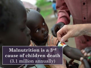 Malnutrition is a 3rd
cause of children death
(3.1 million annually)
 