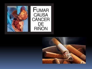 Sustancias Psicoactivas 