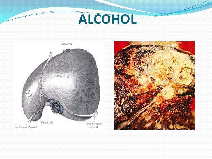 La codificación del alcohol en penze la dirección