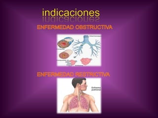 indicacionesENFERMEDAD OBSTRUCTIVAENFERMEDAD RESTRICTIVA