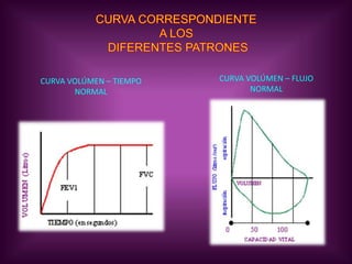 EL VALOR FEV1RESULTA FUNDAMENTAL NO SÓLO PARA ESTABLECER EL DIAGNÓSTICO SINO TAMBIÉN PARA ESTABLECER EL GRADO DE SEVERIDAD DE LA ENFERMEDAD.EL HALLAZGO DE UNA ESPIROMETRÍA OBSTRUCTIVA OBLIGA A LA REALIZACIÓN DE UNA PRUEBA BRONCODILATADORA.NUEVA CURVA  FLUJO/VOLÚMEN«BRONCODILATADOR, BETA-2 AGONISTA DE ACCIÓN CORTA»