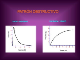 VÍAS AÉREASASMA BRONQUIAL.