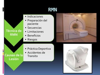 RMN
Técnica de
RMN
• Indicaciones
• Preparación del
paciente
• Secuencias
• Limitaciones
• Beneficios
• Riesgos
Causas de la
Lesión
• Práctica Deportiva
• Accidentes de
Transito
 