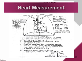 23
Heart Measurement
 