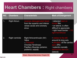 NO Chambers Characteristic Mark of Enlargement
1. Right Atrium receives deoxygenated blood
from the superior and inferior
venae cavae and coronary
sinus
• detected best on
frontal film
• on lateral, is often
difficult to appreciate
• right heart border > 1/3
right hemithorax
2. Right ventricle Right Atrioventricular (AV)
Valve
-- Tricuspid
Chordae Tendineae
Papillary Muscles (anterior,
posterior, septal)
• rotates to the left
around its long axis
• elevation of the cardiac
apex (PA)
• extends cranially
behind the sternum
(lateral)
9
Heart Chambers : Right chambers
Breen, Mayocardiacreview, Chapter 56
 