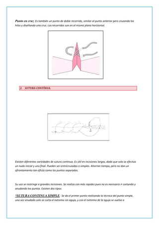 Punto en cruz: Es también un punto de doble recorrido, similar al punto anterior pero cruzando los
hilos y diseñando una cruz. Los recorridos son en el mismo plano horizontal.

2. SUTURA CONTÍNUA.

Existen diferentes variedades de sutura continua. Es útil en incisiones largas, dado que solo se efectúa
un nudo inicial y uno final. Pueden ser entrecruzadas o simples. Ahorran tiempo, pero no dan un
afrontamiento tan eficáz como los puntos separados.

Su uso se restringe a grandes incisiones. Se realiza con más rapidez pues no es necesario ir cortando y
anudando los puntos. Existen dos tipos:

*SUTURA CONTINUA SIMPLE: Se da el primer punto realizando la técnica del punto simple,
una vez anudado solo se corta el extremo sin aguja, y con el extremo de la aguja se vuelve a

 