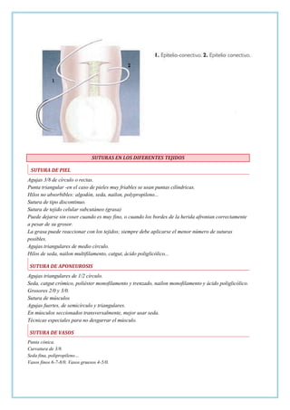 SUTURAS EN LOS DIFERENTES TEJIDOS
SUTURA DE PIEL
Agujas 3/8 de círculo o rectas.
Punta triangular -en el caso de pieles muy friables se usan puntas cilíndricas.
Hilos no absorbibles: algodón, seda, nailon, polypropileno...
Sutura de tipo discontinuo.
Sutura de tejido celular subcutáneo (grasa)
Puede dejarse sin coser cuando es muy fino, o cuando los bordes de la herida afrontan correctamente
a pesar de su grosor.
La grasa puede reaccionar con los tejidos; siempre debe aplicarse el menor número de suturas
posibles.
Agujas triangulares de medio círculo.
Hilos de seda, nailon multifilamento, catgut, ácido poliglicólico...
SUTURA DE APONEUROSIS
Agujas triangulares de 1/2 círculo.
Seda, catgut crómico, poliéster monofilamento y trenzado, nailon monofilamento y ácido poliglicólico.
Grosores 2/0 y 3/0.
Sutura de músculos
Agujas fuertes, de semicírculo y triangulares.
En músculos seccionados transversalmente, mejor usar seda.
Técnicas especiales para no desgarrar el músculo.
SUTURA DE VASOS
Punta cónica.
Curvatura de 3/8.
Seda fina, polipropileno…
Vasos finos 6-7-8/0. Vasos gruesos 4-5/0.

 