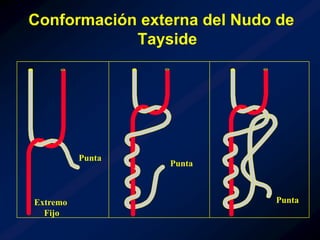 Tipos de suturas y nudos en cirugia general y laparoscopica | PPT