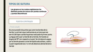 Los grupos en los cuales englobamos los
distintos puntos de sutura son puntos continuos
y puntos discontinuos
PUNTOS CONTINUOS
Es una sucesión depuntos queunen los bordesdela
herida.Lo primeroquerealizamoses un lazo quenos
servirádetope cuandohayamosrealizadoel primer punto.
LaAgujaentra por un bordedela herida,formandoun
ángulo de90ºcon respecto a la piel. Se introducela aguja
por el bordeopuestoanivel detejidosubcutáneo,y salea
la pielrespetandolos 3-4mm dedistanciadelbordedela
herida
 