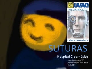 SUTURAS
 Hospital Cibernético
       Segundo semestre ‘’A’’
       Torres Colindres Mili Denize
       01,06,2012
 