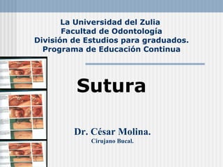 La Universidad del Zulia  Facultad de Odontología División de Estudios para graduados. Programa de Educación Continua Sutura Dr. César Molina. Cirujano Bucal. 