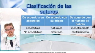Clasificación de las
suturas
De acuerdo a su
absorción
De acuerdo con
su origen
De acuerdo con
el numero de
hebras
absorbibles naturales monofilamento
No absorbibles sintéticas multifilamento
 