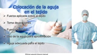 Colocación de la aguja
en el tejido
 Fuerza aplicada sobre el tejido
 Toma de porciones
 Fuerza ejercida
 Uso de la aguja para aproximación
 Aguja adecuada para el tejido
Ethicon wound closure manual
 