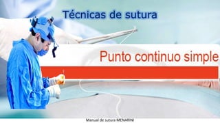 Técnicas de sutura
Manual de sutura MENARINI
 