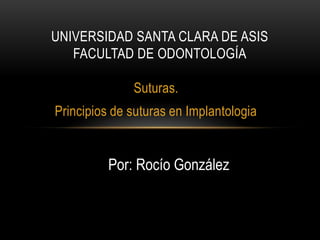 Suturas.
Principios de suturas en Implantologia
UNIVERSIDAD SANTA CLARA DE ASIS
FACULTAD DE ODONTOLOGÍA
Por: Rocío González
 