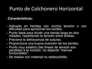 Punto de Colchonero Horizontal •  Características: Indicado en heridas con mucha tensión o con dificultad para aproximar los bordes. Punto ideal para dividir una herida larga en dos mitades, repartiendo la tensión entre ambas.  Previene la dehiscencia de suturas.  Proporciona una buena eversión de los bordes.  Punto muy estético (las líneas de tensión son paralelas a la incisión, no dejando “marcas horizontales”.  Se realiza con material no reabsorbible.   