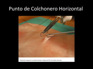 Punto de Colchonero Horizontal  