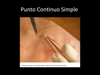 Punto Continuo Simple  