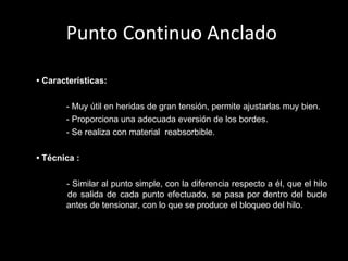 Punto Continuo Anclado     •  Características:     - Muy útil en heridas de gran tensión, permite ajustarlas muy bien.   - Proporciona una adecuada eversión de los bordes.   - Se realiza con material  reabsorbible.    •  Técnica   :   - Similar al punto simple, con la diferencia respecto a él, que el hilo   de salida de cada punto efectuado, se pasa por dentro del bucle   antes de tensionar, con lo que se produce el bloqueo del hilo.   