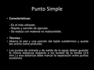 Punto Simple Características:   - Es el más utilizado. - Rápido y sencillo de ejecutar. - Se realiza con material no reabsorbible.   Técnica   : Abarca la piel y una porción del tejido subdérmico y queda tan ancho como profundo. Los puntos de entrada y de salida de la aguja deben guardar la misma distancia respecto a los bordes de la herida (3-5 mm.) y esa distancia debe marcar la separación entre puntos sucesivos.   