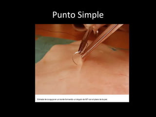 Punto Simple 