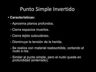 Punto Simple Invertido  •  Características:     - Aproxima planos profundos.   -   Cierra espacios muertos.   -   Cierra tejido subcutáneo.   - Disminuye la tensión de la herida.   - Se realiza con material reabsorbible, cortando el nudo a ras.   - Similar al punto simple, pero el nudo queda en profundidad (enterrado).   