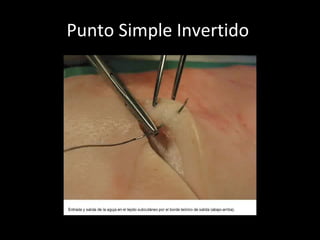 Punto Simple Invertido  