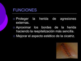 FUNCIONES
la herida de agresiones
 Proteger
externas.
 Aproximar los bordes de la herida
haciendo la reepitelización más sencilla.
 Mejorar el aspecto estético de la cicatriz.
 