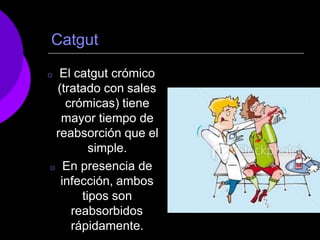 Catgut
 El catgut crómico
(tratado con sales
crómicas) tiene
mayor tiempo de
reabsorción que el
simple.
 En presencia de
infección, ambos
tipos son
reabsorbidos
rápidamente.
 