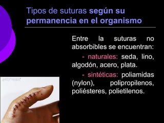 Tipos de suturas según su
permanencia en el organismo

          Entre la suturas no
          absorbibles se encuentran:
              - naturales: seda, lino,
          algodón, acero, plata.
              - sintéticas: poliamidas
          (nylon),      polipropilenos,
          poliésteres, polietilenos.
 