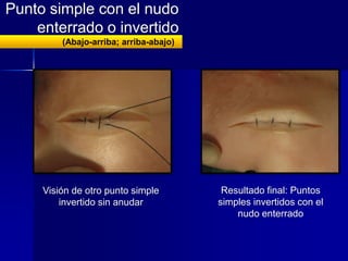 clase-magistral-de-suturas-pptx
