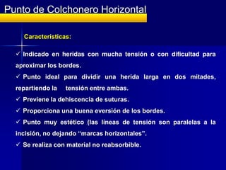 Punto de Colchonero Horizontal




   Visión del recorrido de los
                                 Doble lazada (nudo de
 ...
